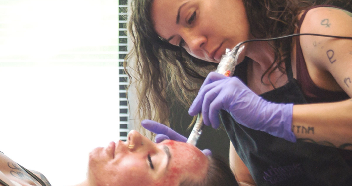 Advanced-Microneedling-Service-Utah