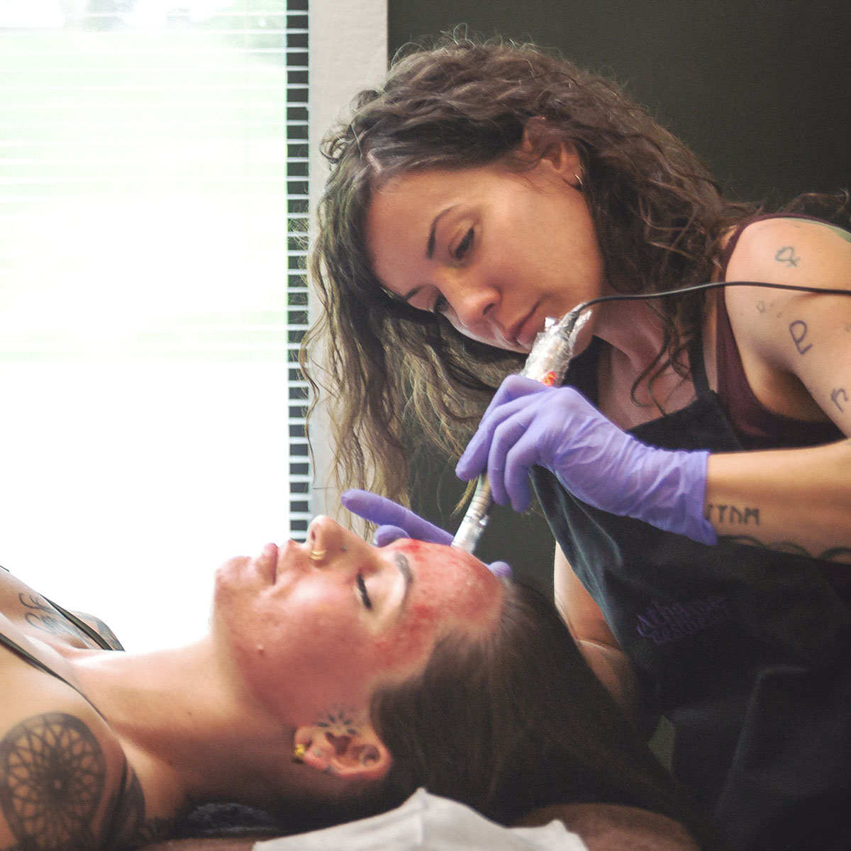 Advanced-Microneedling-Service-Utah
